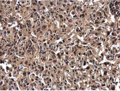 Immunohistochemistry-Paraffin ZNF406 Antibody