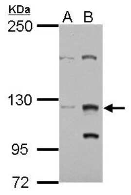 Western Blot ZNF406 Antibody