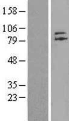 Western Blot: ZNF41 Overexpression Lysate (Adult Normal) [NBL1-18144] Left-Empty vector transfected control cell lysate (HEK293 cell lysate); Right -Over-expression Lysate for ZNF41.