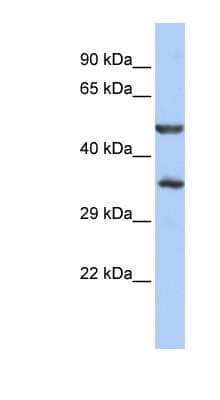 Western Blot: ZNF414 Antibody [NBP1-80378] - HepG2 cell lysate, concentration 0.2-1 ug/ml.