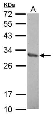 Western Blot: ZNF414 Antibody [NBP2-21009] - Sample (30 ug of whole cell lysate) A: A549 12% SDS PAGE gel, diluted at 1:1000.