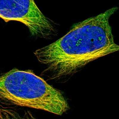 Immunocytochemistry/Immunofluorescence: ZNF415 Antibody [NBP1-89466] - Immunofluorescent staining of human cell line U-2 OS shows localization to nucleoli fibrillar center & microtubules.