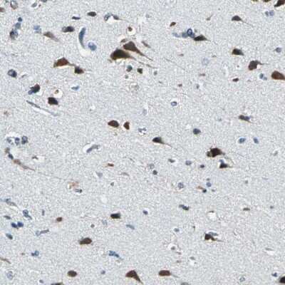 Immunohistochemistry-Paraffin: ZNF415 Antibody [NBP1-89466] - Staining of human cerebral cortex shows strong cytoplasmic positivity in neuronal cells.