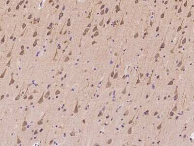 Immunohistochemistry-Paraffin: ZNF415 Antibody [NBP2-98201] - Immunochemical staining of human ZNF415 in human brain with rabbit polyclonal antibody at 1:100 dilution, formalin-fixed paraffin embedded sections.