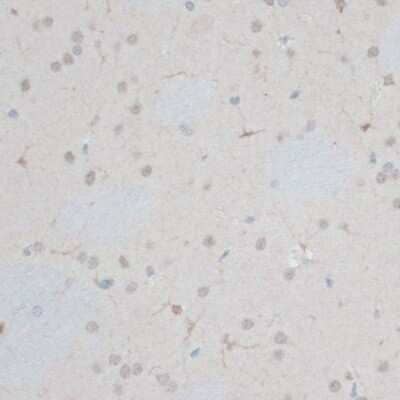 Immunohistochemistry-Paraffin: ZNF415 Antibody [NBP3-04366] - Paraffin-embedded rat brain using ZNF415 antibody at dilution of 1:100 (40x lens).