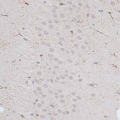 Immunohistochemistry-Paraffin: ZNF415 Antibody [NBP3-04366] - Paraffin-embedded mouse brain using ZNF415 antibody at dilution of 1:100 (40x lens).
