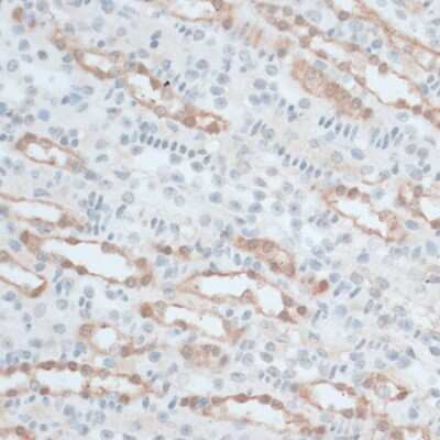 Immunohistochemistry-Paraffin: ZNF415 Antibody [NBP3-04366] - Paraffin-embedded mouse kidney using ZNF415 antibody at dilution of 1:100 (40x lens).