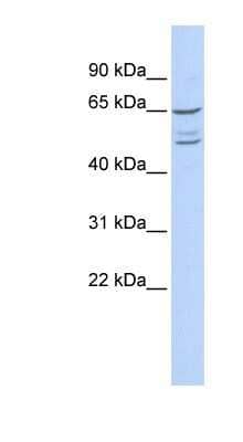Western Blot: ZNF415 Antibody [NBP1-80340] - 293T cells lysate, concentration 0.2-1 ug/ml.