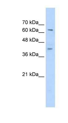 Western Blot: ZNF415 Antibody [NBP1-80341] - Jurkat cell lysate, concentration 0.2-1 ug/ml.