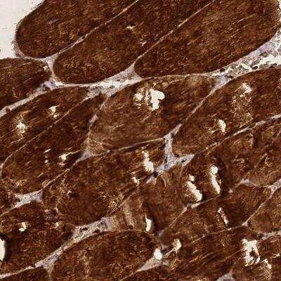 Immunohistochemistry: ZNF417 Antibody [NBP2-46668] - Staining of human skeletal muscle shows strong cytoplasmic and nuclear positivity in myocytes.