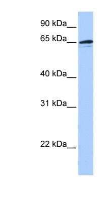 Western Blot: ZNF417 Antibody [NBP1-80159] - Titration: 0.2-1 ug/ml, Positive Control: Human brain.