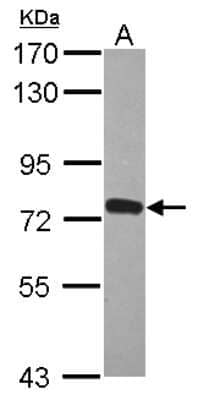 Western Blot: ZNF417 Antibody [NBP2-21011] - Sample (30 ug of whole cell lysate) A: MCF-7 7. 5% SDS PAGE gel, diluted at 1:1000.