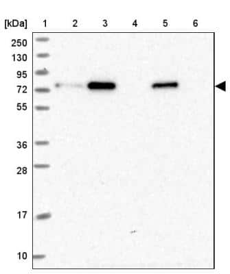 Western Blot: ZNF417 Antibody [NBP2-46668] - Lane 1: Marker  [kDa] 250, 130, 95, 72, 55, 36, 28, 17, 10.  Lane 2: Human cell line RT-4.  Lane 3: Human cell line U-251 MG.  Lane 4: Human plasma  Lane 5: Human Liver tissue.  Lane 6: Human Tonsil tissue