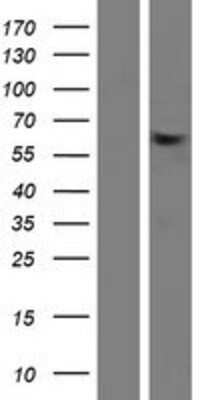 Western Blot: ZNF417 Overexpression Lysate (Adult Normal) [NBP2-05365] Left-Empty vector transfected control cell lysate (HEK293 cell lysate); Right -Over-expression Lysate for ZNF417.