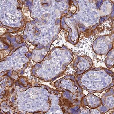 Immunohistochemistry: ZNF418 Antibody [NBP2-33403] - Staining of human placenta shows strong membranous positivity in placental trophoblastic cells.