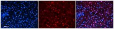Immunohistochemistry-Paraffin: ZNF419A Antibody [NBP3-10516] - Immunohistochemical analysis of formalin-fixed paraffin-embedded human adult liver tissue.