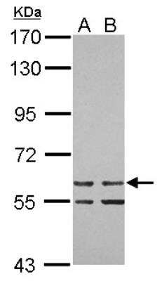 Western Blot: ZNF419A Antibody [NBP2-21013] - Sample (30 ug of whole cell lysate) A: 293T B: A431 7. 5% SDS PAGE gel, diluted at 1:1000.