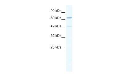 Western Blot: ZNF419A Antibody [NBP3-10386] - Western blot analysis using NBP3-10386 on Human Jurkat as a positive control. Antibody Titration: 0.125ug/ml