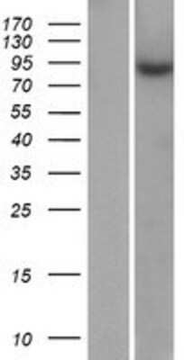 Western Blot: ZNF425 Overexpression Lysate (Adult Normal) [NBP2-08954] Left-Empty vector transfected control cell lysate (HEK293 cell lysate); Right -Over-expression Lysate for ZNF425.