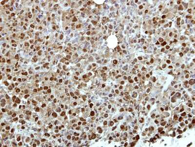 Immunohistochemistry-Paraffin: ZNF426 Antibody [NBP2-21015] - Immunohistochemical analysis of paraffin-embedded MDA-MB231 xenograft, using antibody at 1:500 dilution.