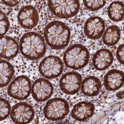 Immunohistochemistry: ZNF428 Antibody [NBP2-31922] - Staining of human colon shows strong cytoplasmic and nuclear positivity in glandular cells.