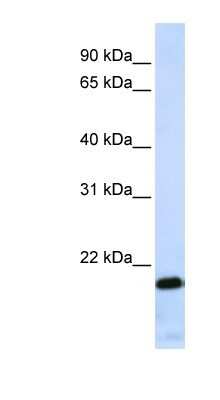 Western Blot: ZNF428 Antibody [NBP1-80435] - Jurkat cell lysate, concentration 0.2-1 ug/ml.