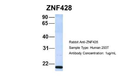 Western Blot: ZNF428 Antibody [NBP1-80435] - Analysis of 293T cell lysate. Antibody Dilution: 1.0 ug/ml ZNF428 is supported by BioGPS gene expression data to be expressed in HEK293T.