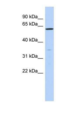 Western Blot ZNF431 Antibody - BSA Free