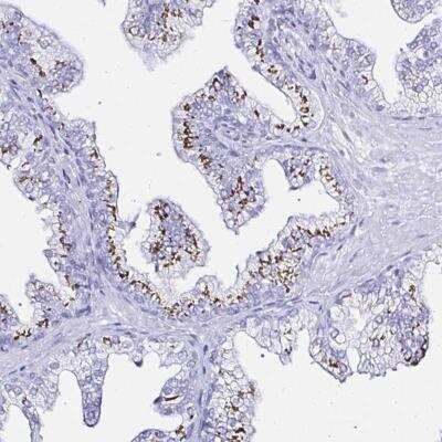 Immunohistochemistry-Paraffin: ZNF432 Antibody [NBP2-31813] - Staining of human prostate shows strong granular cytoplasmic positivity in glandular cells.