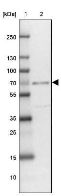 Western Blot: ZNF432 Antibody [NBP2-31813] - Lane 1: Marker  [kDa] 250, 130, 100, 70, 55, 35, 25, 15, 10.  Lane 2: Liver