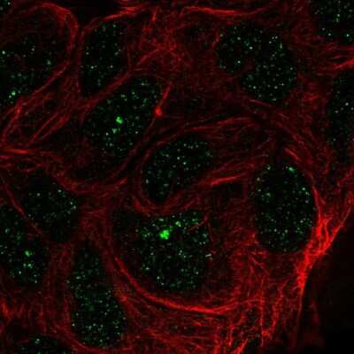 Immunocytochemistry/Immunofluorescence: ZNF433 Antibody [NBP2-58010] - Staining of human cell line RT4 shows localization to nuclear bodies.