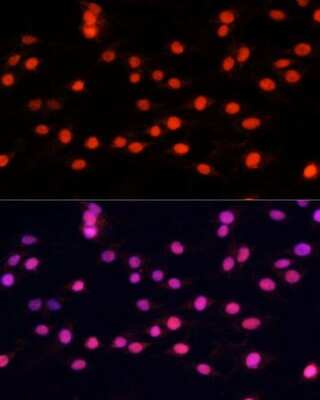 Immunocytochemistry/Immunofluorescence: ZNF433 Antibody [NBP3-05110] - Immunofluorescence analysis of C6 cells using ZNF433 Polyclonal Antibody (NBP3-05110) at dilution of 1:100 (40x lens). Blue: DAPI for nuclear staining.
