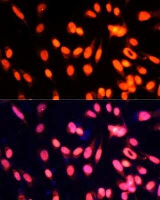 Immunocytochemistry/Immunofluorescence: ZNF433 Antibody [NBP3-05110] - Immunofluorescence analysis of NIH-3T3 cells using ZNF433 Polyclonal Antibody (NBP3-05110) at dilution of 1:100 (40x lens). Blue: DAPI for nuclear staining.