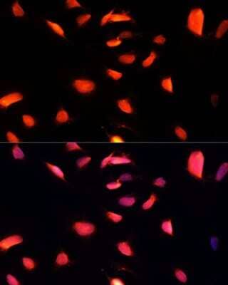Immunocytochemistry/Immunofluorescence: ZNF433 Antibody [NBP3-05110] - Immunofluorescence analysis of U-2 OS cells using ZNF433 Polyclonal Antibody (NBP3-05110) at dilution of 1:100 (40x lens). Blue: DAPI for nuclear staining.