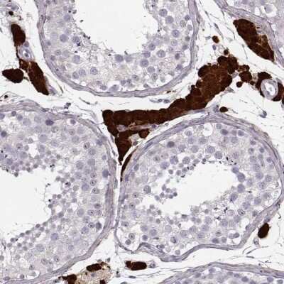 Immunohistochemistry-Paraffin: ZNF433 Antibody [NBP2-58010] - Immunohistochemical staining of human testis shows strong nuclear and cytoplasmic positivity in Leydig cells.