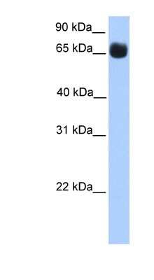 Western Blot: ZNF433 Antibody [NBP1-79369] - Human Muscle lysate, concentration 0.2-1 ug/ml.