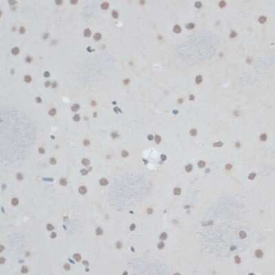 Western Blot: ZNF433 Antibody [NBP3-05110] - Paraffin-embedded rat brain using ZNF433 antibody at dilution of 1:100 (40x lens).