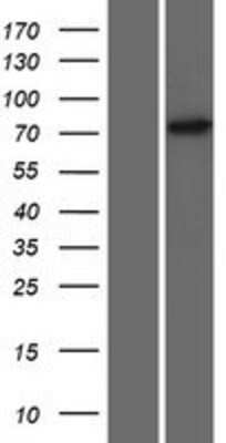 Western Blot: ZNF433 Overexpression Lysate (Adult Normal) [NBP2-08489] Left-Empty vector transfected control cell lysate (HEK293 cell lysate); Right -Over-expression Lysate for ZNF433.