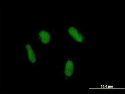 Immunocytochemistry/ Immunofluorescence ZNF436 Antibody - Azide and BSA Free