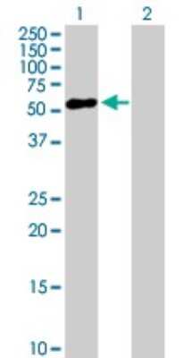 Western Blot ZNF436 Antibody - Azide and BSA Free