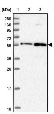 Western Blot: ZNF436 Antibody [NBP1-82897] - Lane 1: Marker  [kDa] 250, 130, 95, 72, 55, 36, 28, 17, 10.  Lane 2: Human cell line RT-4.  Lane 3: Human cell line U-251MG sp