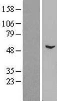 Western Blot: ZNF436 Overexpression Lysate (Adult Normal) [NBL1-18154] Left-Empty vector transfected control cell lysate (HEK293 cell lysate); Right -Over-expression Lysate for ZNF436.