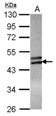 Western Blot: ZNF439 Antibody [NBP2-21017] - Sample (30 ug of whole cell lysate) A: MCF-7 10% SDS PAGE gel, diluted at 1:1000.