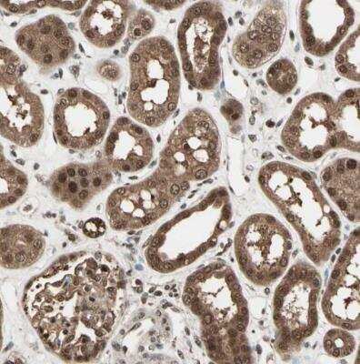 Immunohistochemistry-Paraffin: ZNF44 Antibody [NBP1-81344] - Staining of human kidney shows strong cytoplasmic and nuclear positivity in cells in tubules.