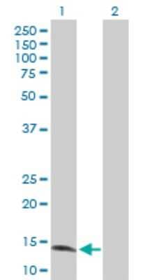 Western Blot: ZNF44 Antibody [H00051710-D01P] - Analysis of ZNF44 expression in transfected 293T cell line by ZNF44 polyclonal antibody.Lane 1: ZNF44 transfected lysate(17.50 KDa).Lane 2: Non-transfected lysate.