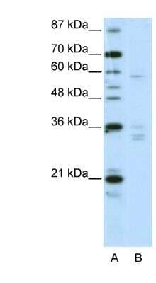 Western Blot ZNF440 Antibody - BSA Free
