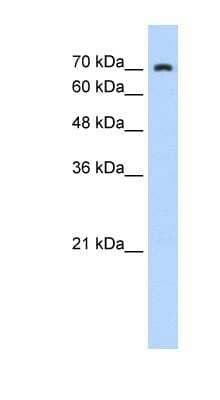 Western Blot: ZNF441 Antibody [NBP1-80153] - HepG2 cell lysate, concentration 0.2-1 ug/ml.