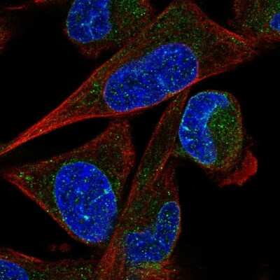 Immunocytochemistry/Immunofluorescence: ZNF442 Antibody [NBP2-54992] - Staining of human cell line RH-30 shows localization to nuclear membrane.