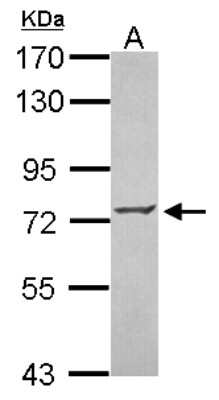 Western Blot: ZNF443 Antibody [NBP2-21018] - Sample (30 ug of whole cell lysate) A: MCF-7 7. 5% SDS PAGE gel, diluted at 1:1000.