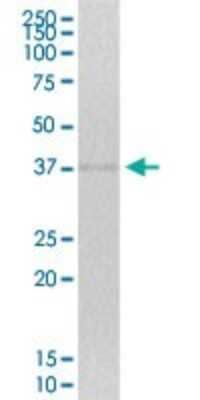 Western Blot: ZNF444 Antibody [H00055311-B01P] - Analysis of ZNF444 expression in human kidney.